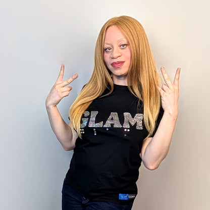 An albino woman poses wearing a shirt that reads "GLAM" in rhinestones with rhinestone braille under the word